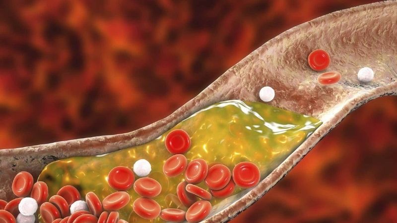 Rutin có thể giúp giảm cholesterol