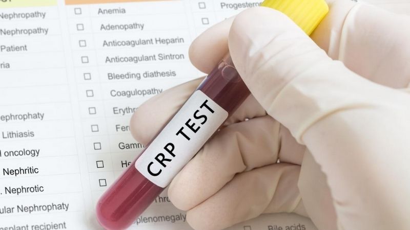 CRP là một xét nghiệm quan trọng để xác định và đánh giá tình trạng viêm hoặc nhiễm trùng.