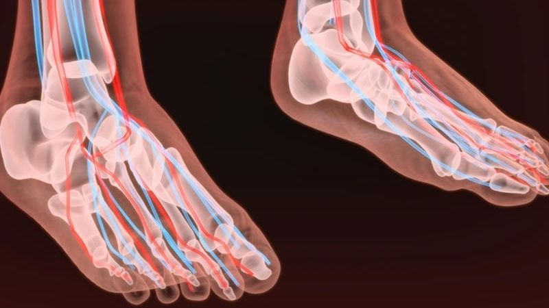 Thần kinh tiểu đường gây ảnh hưởng rõ rệt nhất ở các dây thần kinh ở chân và bàn chân Thần kinh tiểu đường gây ảnh hưởng rõ rệt nhất ở các dây thần kinh ở chân và bàn chân