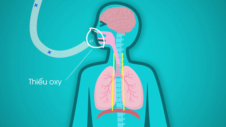 Lack of oxygen due to disorders of cellular respiration