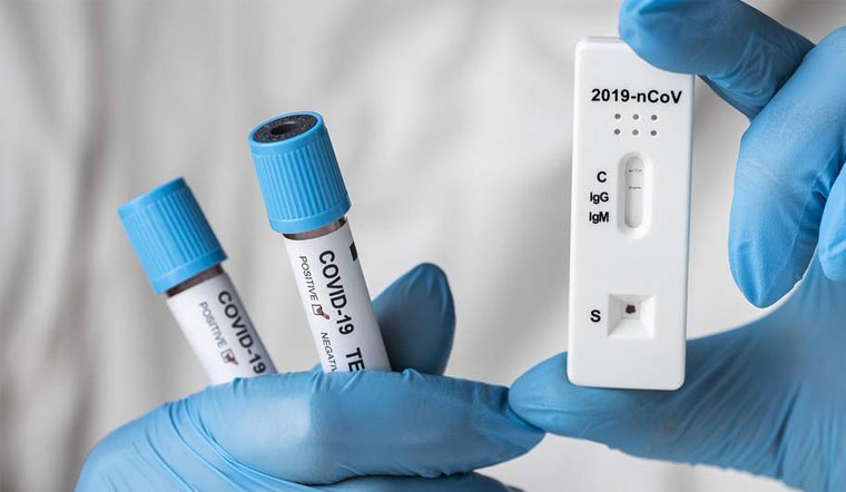 Tiếp xúc với F0 sau bao lâu test mới cho kết quả chính xác