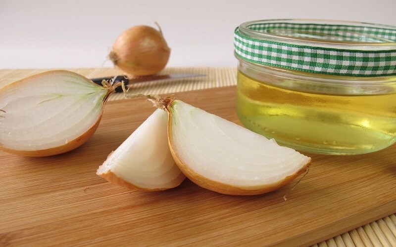 Use onion juice to effectively treat baldness