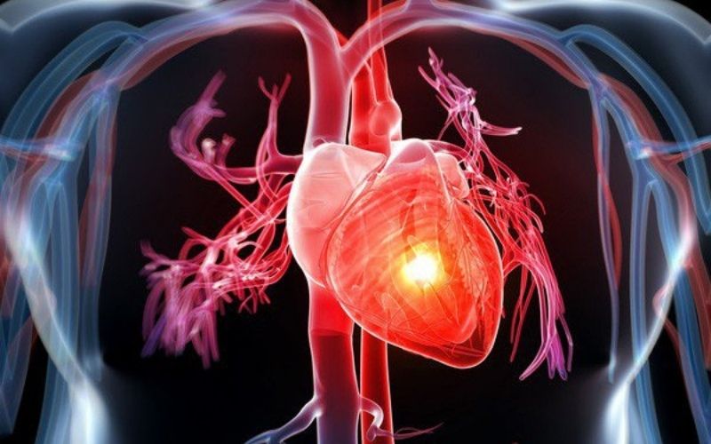 Người mắc các bệnh về tim mạch không nên ăn cay