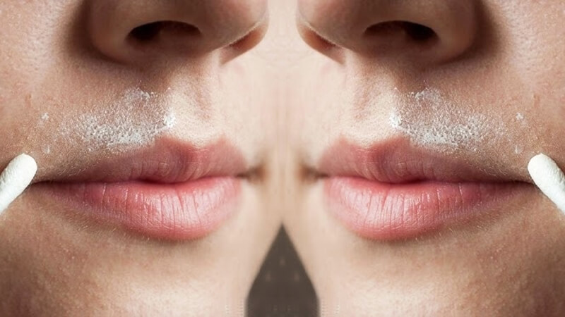 Khi điều trị thâm mép môi tại nhà bạn cần kiên trì và không nên quá lạm dụng chúng
