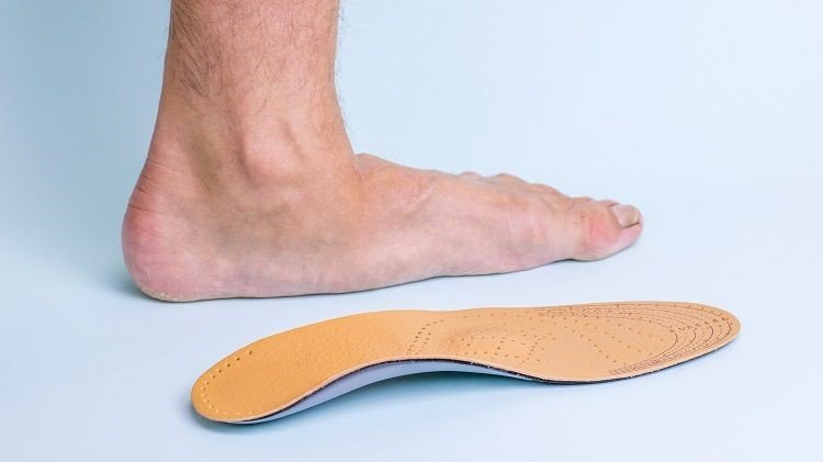 Bàn chân bẹt Nguyên nhân triệu chứng chẩn đoán và phòng ngừa