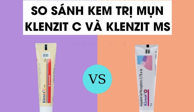 Trị mụn bằng Adapalene Klenzit MS và Klenzit C - sản phẩm nào hiệu quả hơn?