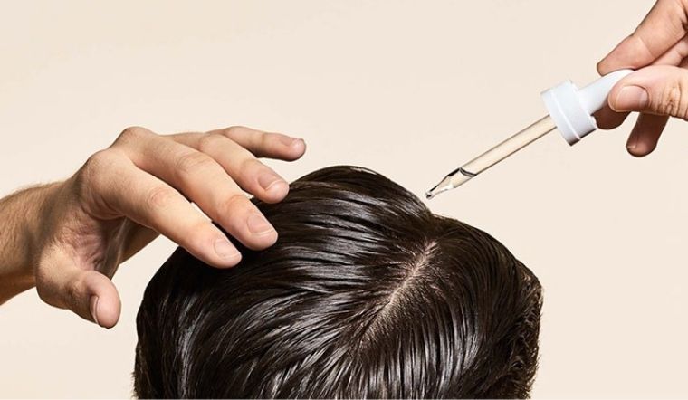 Thuốc trị hói nồng độ minoxidil 2% có tốt không?