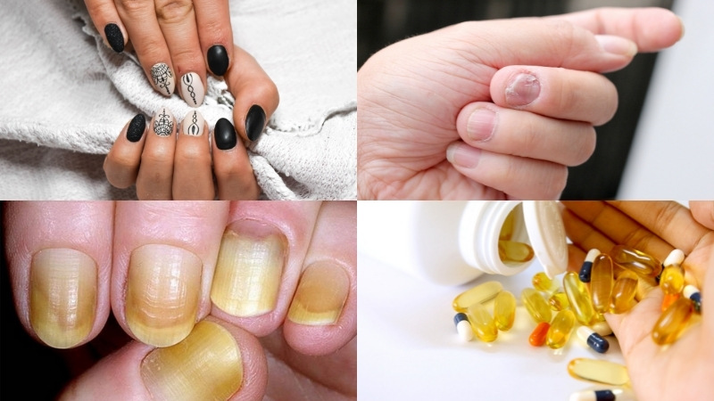 5 ways to clean your nails to keep your hands white and pink