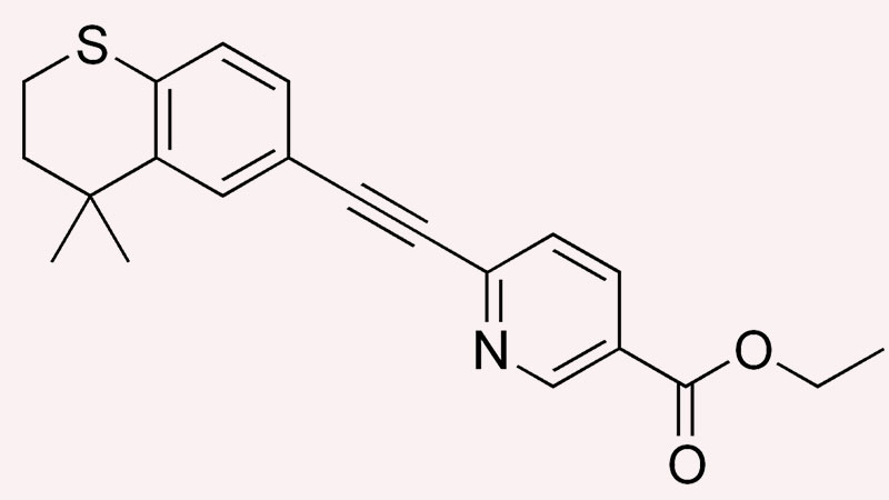 Tìm hiểu về thành phần trị mụn Tazarotene – thế hệ Retinoid thứ ba