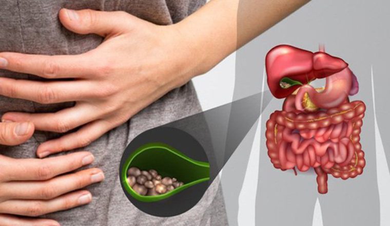7 cách chữa sỏi mật bằng phương pháp dân gian được truyền tai nhiều nhất