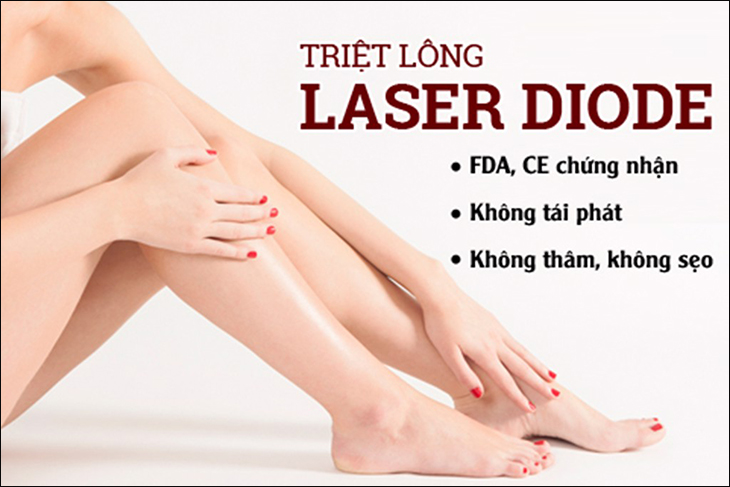 Công nghệ triệt lông Laser Diode