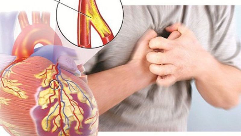 Bệnh tim mạch là một biến chứng nguy hiểm của cholesterol máu cao