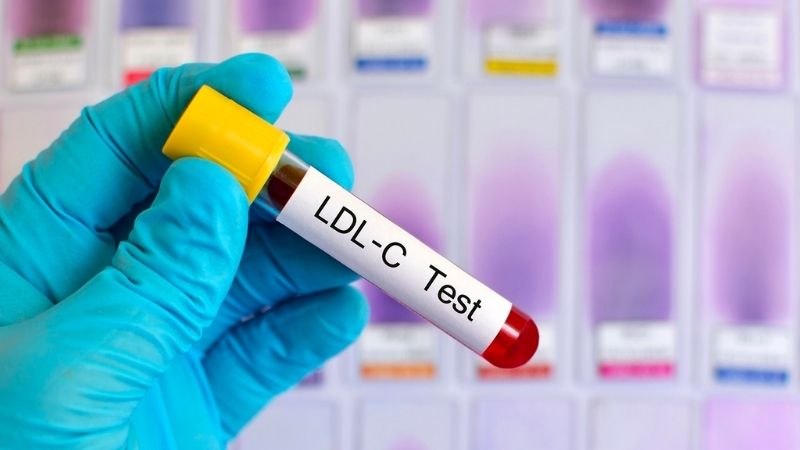 Nồng độ HDL-Cholesterol bình thường trong máu khoảng 40-50 mg/dL (1.0-1.3 mmol/L) ở nam và khoảng 50-59 mg/dl (1.3-1.5 mmol/L) ở nữ.