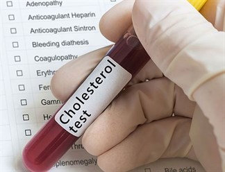 Xét nghiệm cholesterol toàn phần