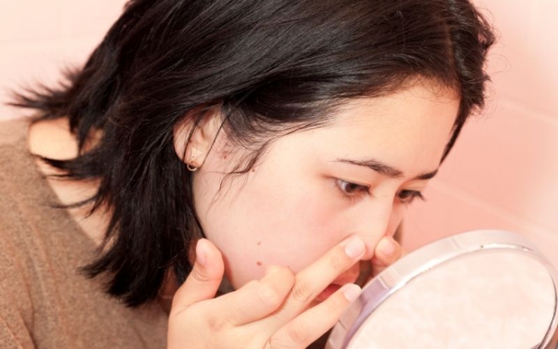 Nước khoáng kiềm thiên nhiên hạn chế việc nổi nhiều mụn