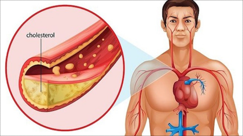 Dây thì canh có tác dụng giảm mỡ máu