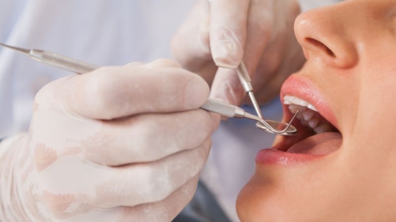 Những lưu ý khi chữa viêm răng bằng cây thuốc nam
