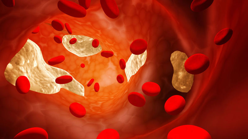 Chất xơ hòa tan có thể giúp giảm tổng mức cholesterol trong máu 