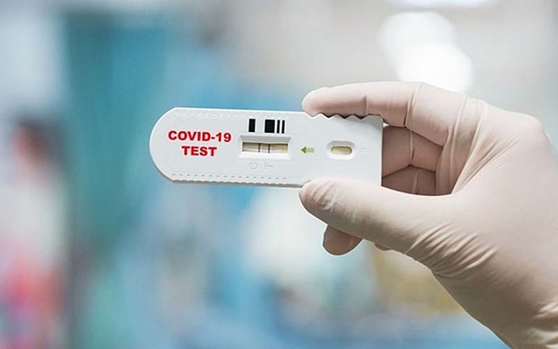 Test covid lên vạch xanh là gì