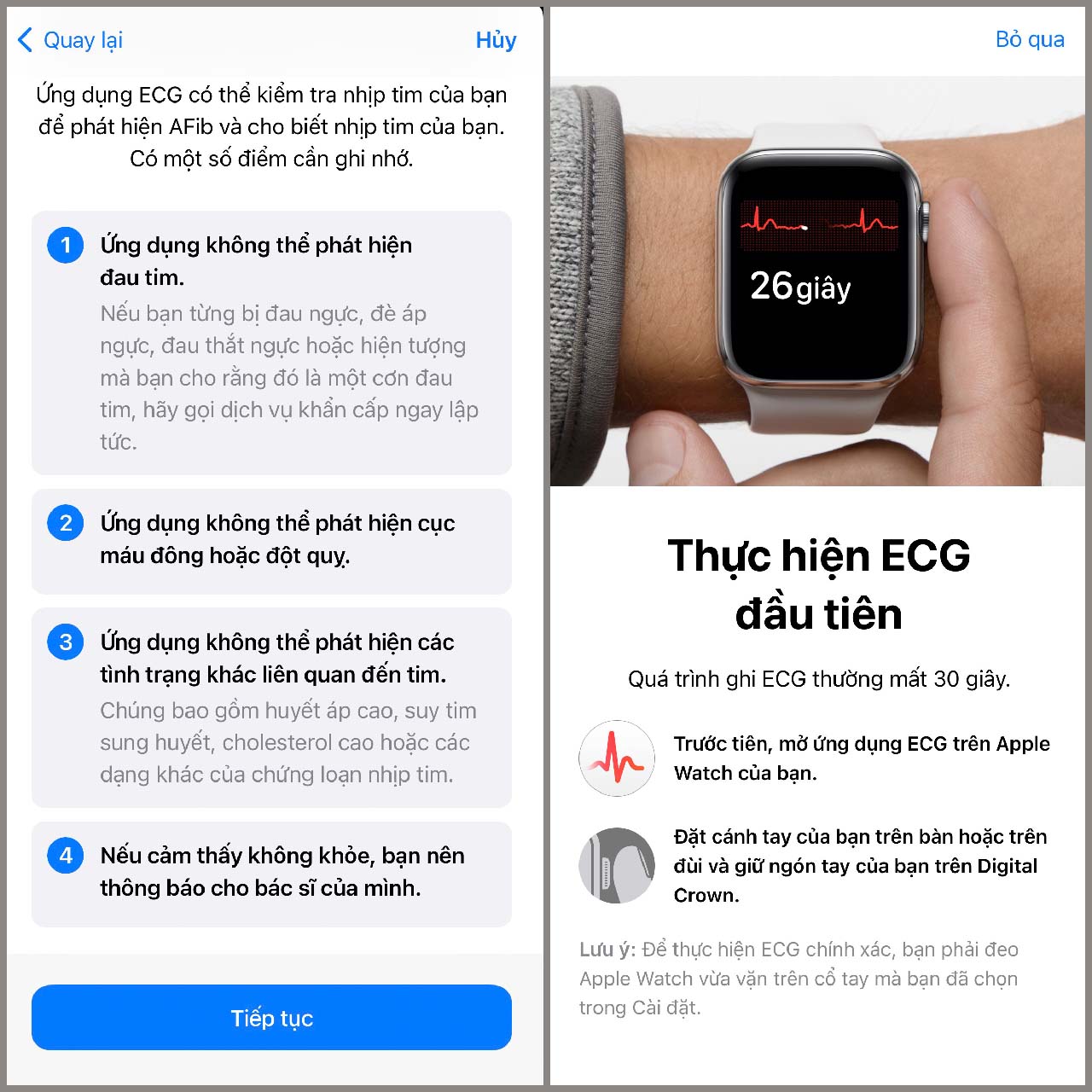 Cách đo điện tâm đồ (ECG) trên Apple Watch