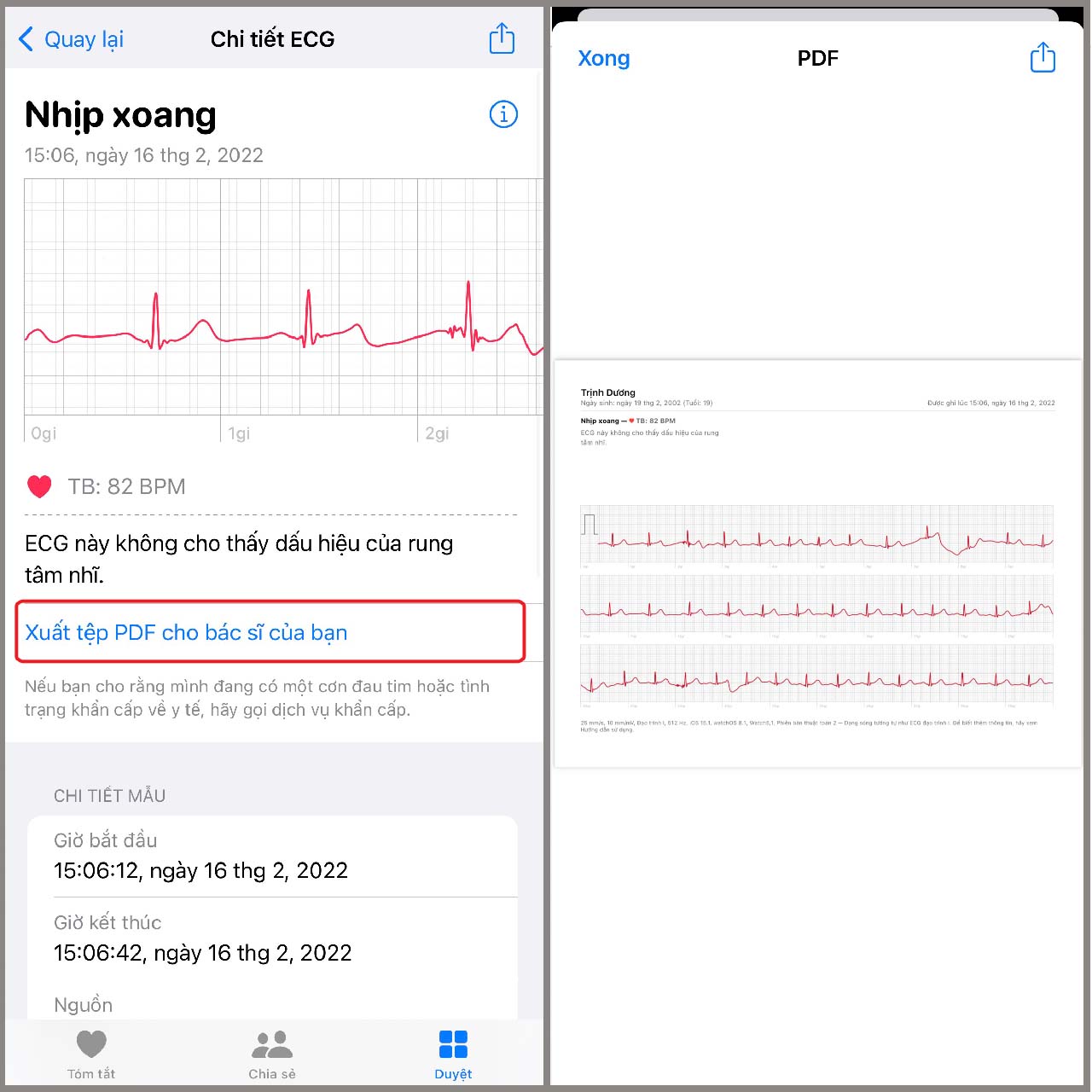 Cách đo điện tâm đồ (ECG) trên Apple Watch