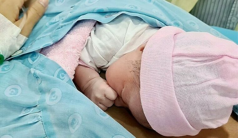 Sản phụ sinh mổ kiêng ăn gì? Nên ăn gì? Kiêng bao lâu?