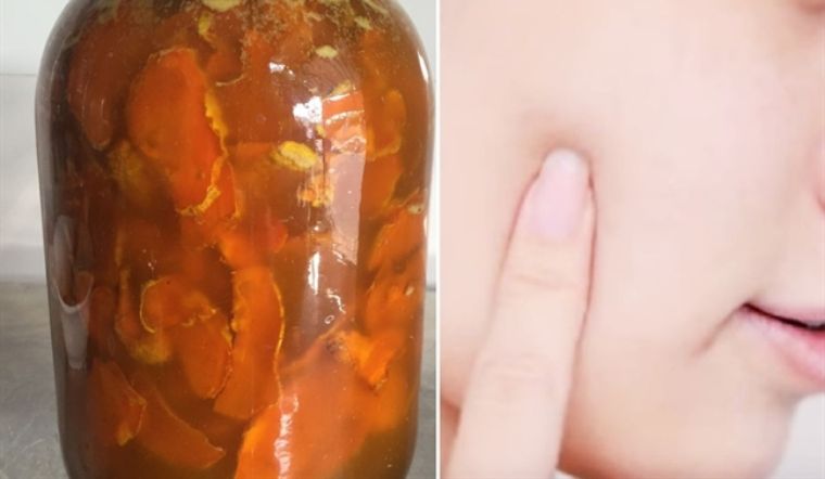 Nghệ ngâm mật ong - Công thức dưỡng trắng da toàn thân mà các chị em phải biết