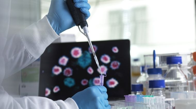 Test PCR Covid bao lâu mới có kết quả?
