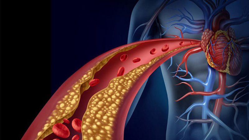 Xuyên tâm liên giúp hạ lipid máu