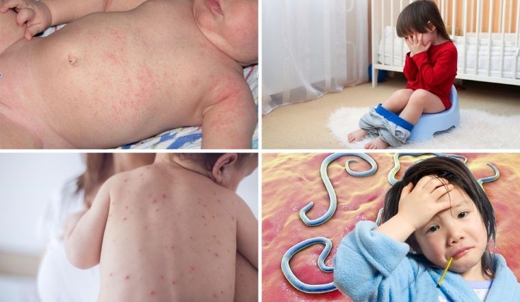 Các bệnh thường gặp ở trẻ ngày nắng nóng