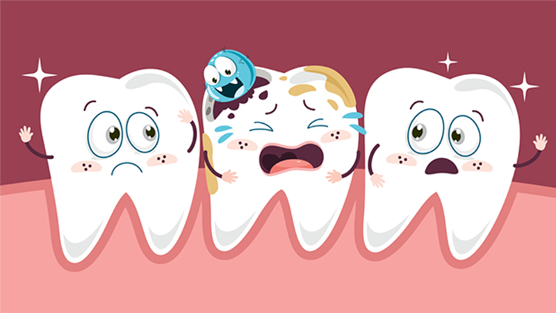 Vông nem có thể giúp ngừa sâu răng