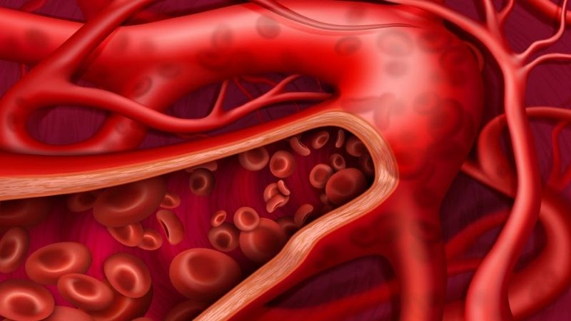 Chiết xuất hạt nho có tác động bảo vệ thành mạch