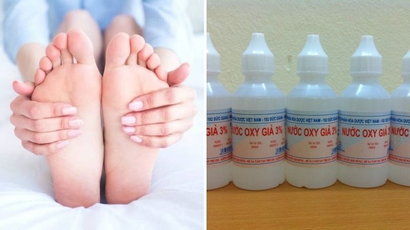 Loại bỏ da khô với nước oxy già