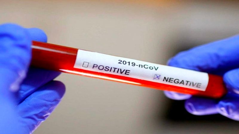 Mẫu dịch sẽ được phân tích và cho ra kết quả test PCR thông qua kỹ thuật Realtime cho ra một trong hai kết quả là dương tính hoặc là âm tính