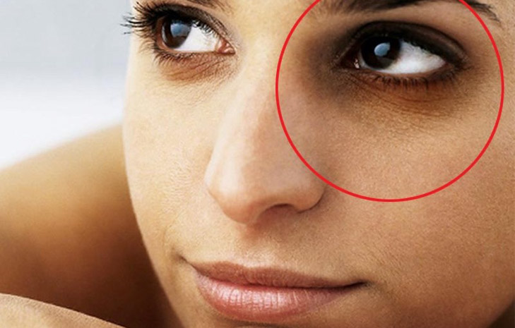 Dấu hiệu lão hoá và 8 cách chăm sóc vùng da mắt bạn nữ nên biết