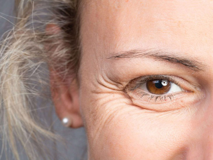 signs of aging in the eye area