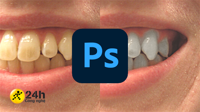 Bí quyết cách làm trắng răng photoshop tự nhiên và hiệu quả