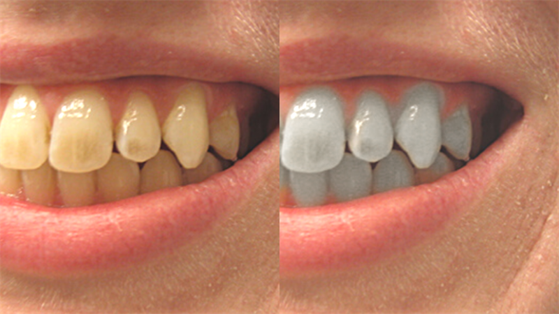 Kết quả cuối cùng.