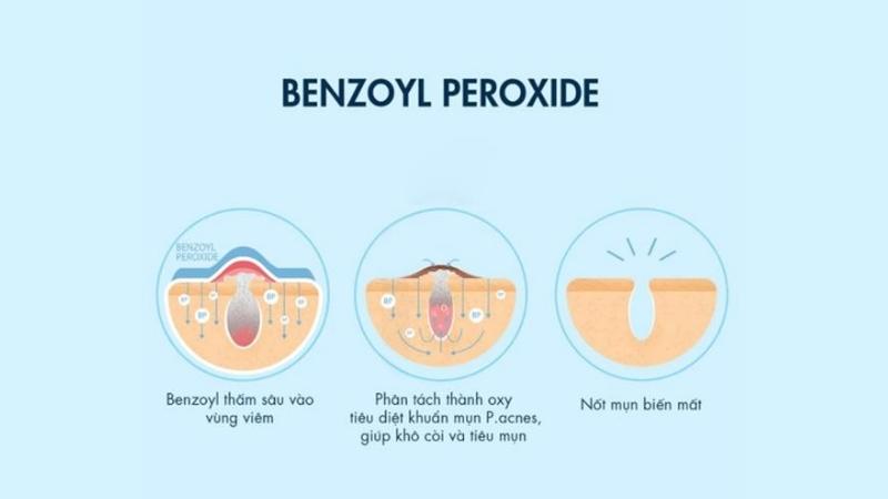 Benzoyl peroxide