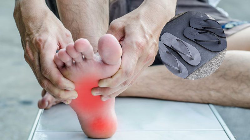 Đi dép xỏ ngón có thể gây chấn thương chân Đi dép xỏ ngón có thể gây chấn thương chân