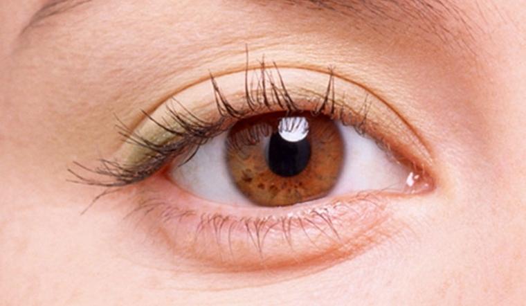 Bọng mắt là gì? Tìm hiểu nguyên nhân và phương pháp điều trị