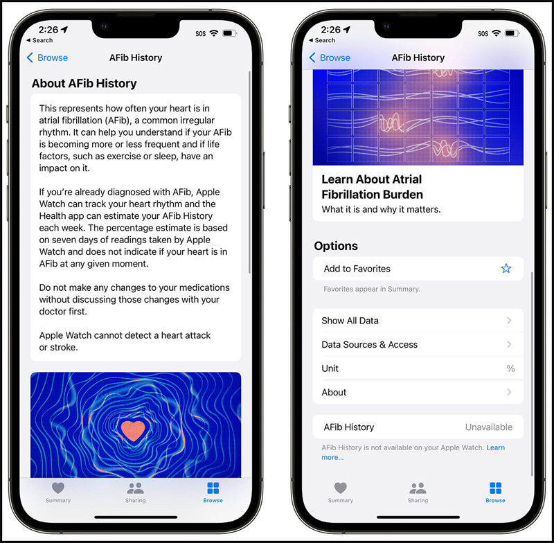 Tính năng Lịch sử Rung nhĩ1