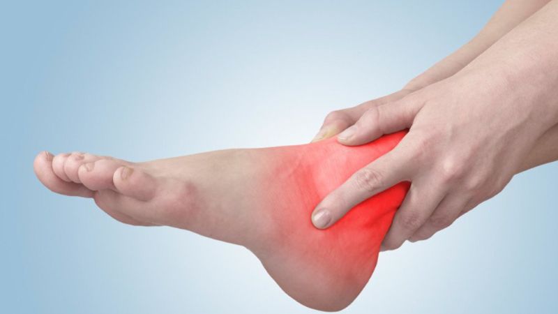 Hội chứng đường hầm cổ chân