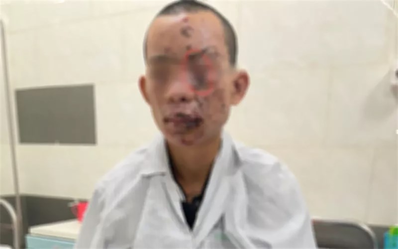 Cảnh báo: Có khả năng bị điện giật khi sử dụng điện thoại đang sạc pin