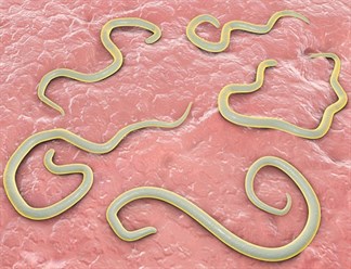 Triệu chứng nhiễm giun bạn cần biết để phát hiện bệnh kịp thời