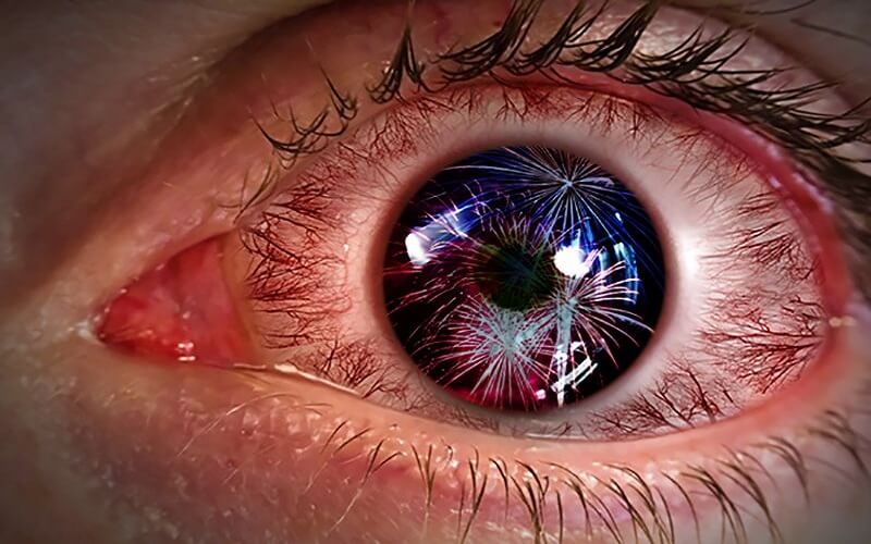 Hình ảnh khi nhìn thấy nhòe, méo mó, mắt bị mờ là triệu chứng thường thấy khi bị loạn thị