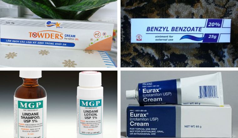 Bị ghẻ nước bôi thuốc gì? Top 4 thuốc bôi ngoài da trị ghẻ hiệu quả