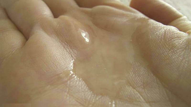 Nước tiểu có trong tinh dịch