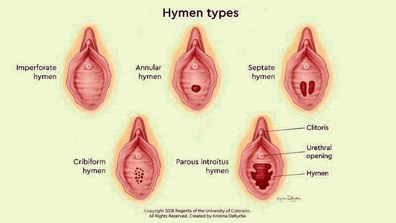 Một số hình ảnh về màng trinh