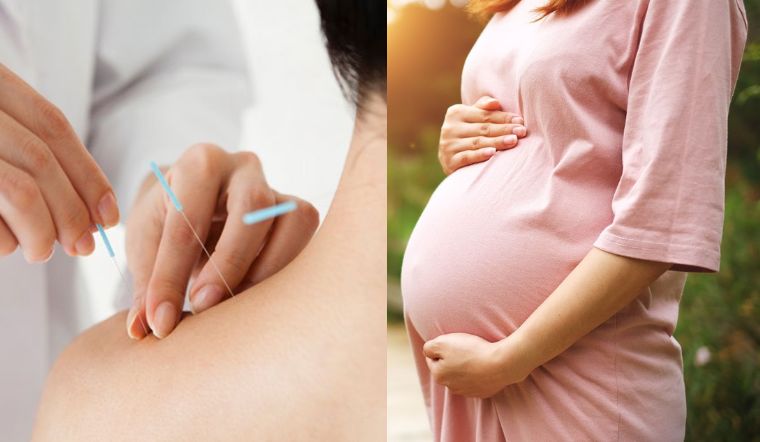 Tăng khả năng thụ thai bằng phương pháp châm cứu có khả quan?